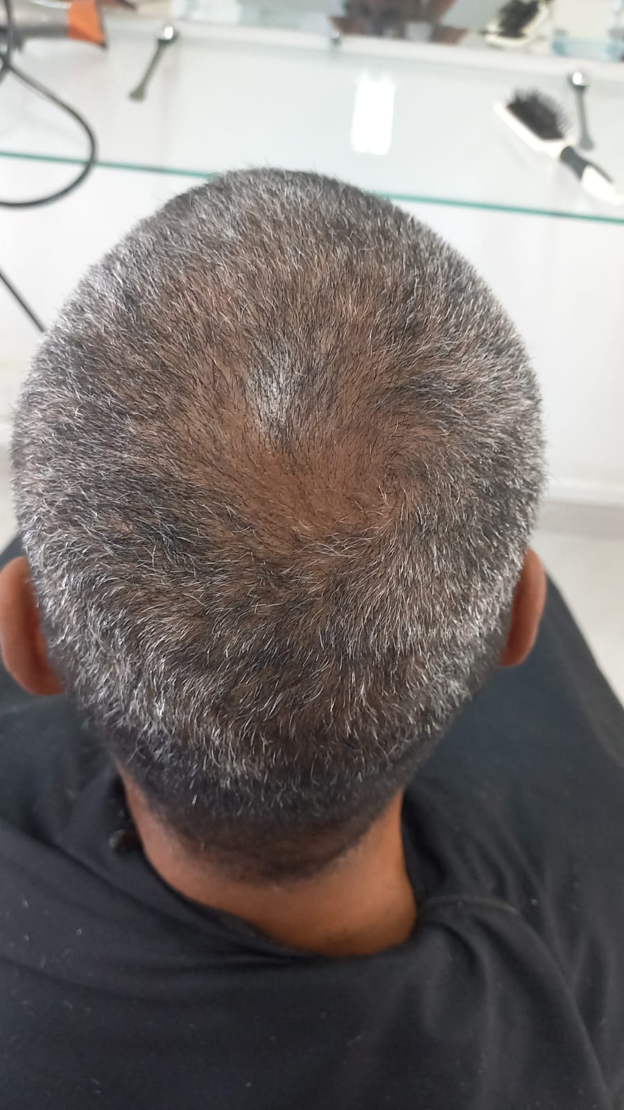 Depois do tratamento — 2 MESES DE TRATAMENTO COM A LINHA DNA VITAL