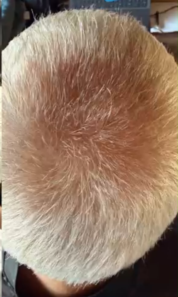 Depois do tratamento — 1 ANO DE TRATAMENTO COM A LINHA DNA VITAL